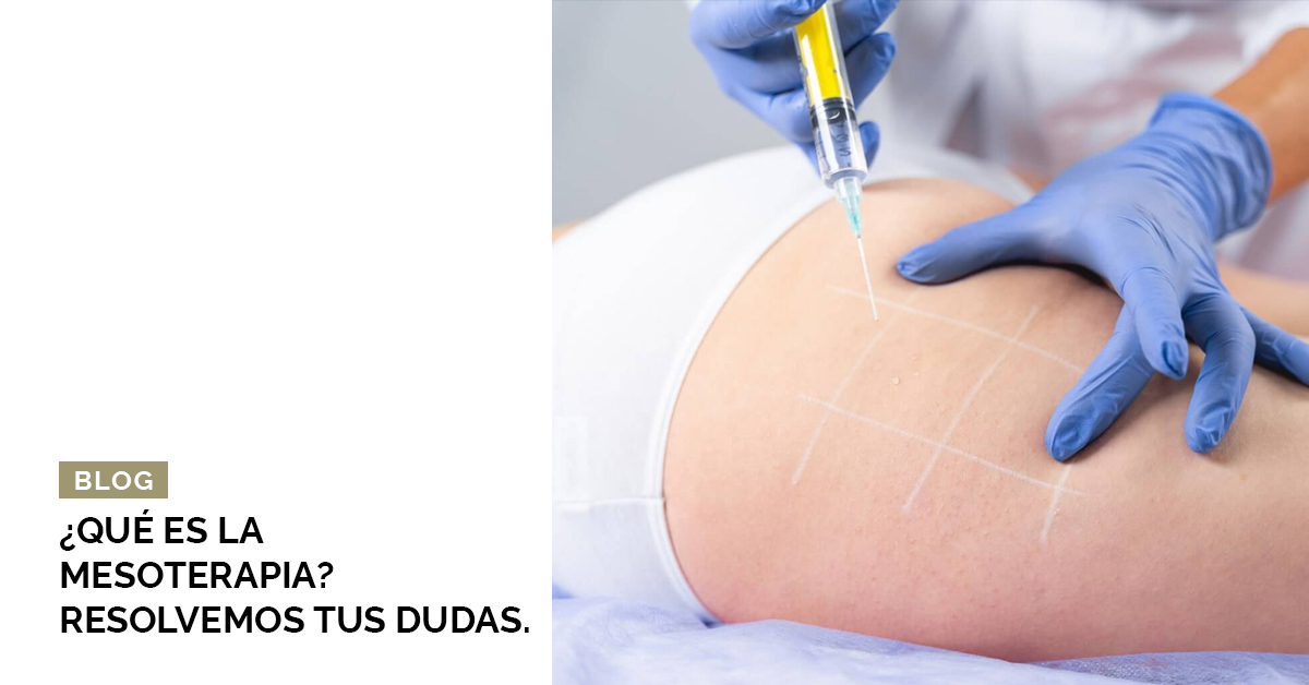 ¿Qué es la mesoterapia? Resolvemos tus