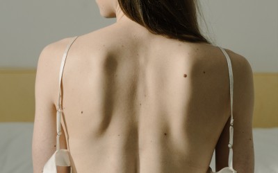 ¿Qué tipos de cicatrices existen en un aumento de pecho? Todo sobre la cicatriz tras un aumento de pecho.