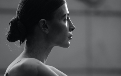 ¿Cómo es el postoperatorio de la rinoplastia?