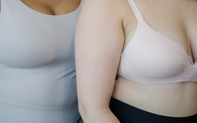 ¿Qué es la Gigantomastia?