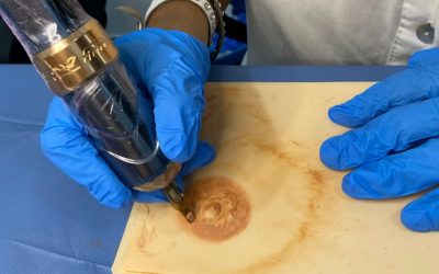 Micropigmentación oncológica: reconstrucción de areola y camuflaje de cicatrices
