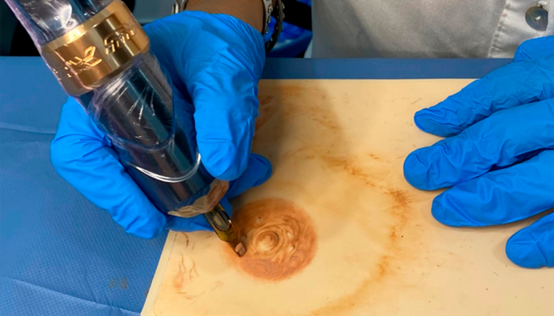 Micropigmentación oncológica: reconstrucción de areola y camuflaje de cicatrices