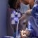 Rinoplastia de preservación: la evolución de la cirugía nasal moderna sin cicatrices